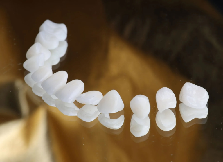 Dental Veneers in Dubai – Sports and Smile: Are There Any Limits?